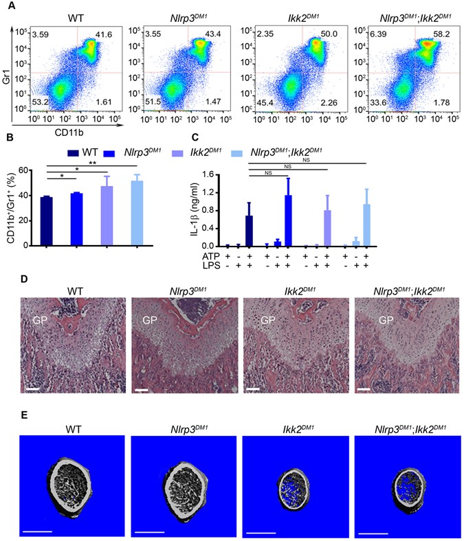Chronic inflammation triggered by the NLRP3 inflammasome in myeloid cells  promotes growth plate dysplasia by mesenchymal cells | Scientific Reports