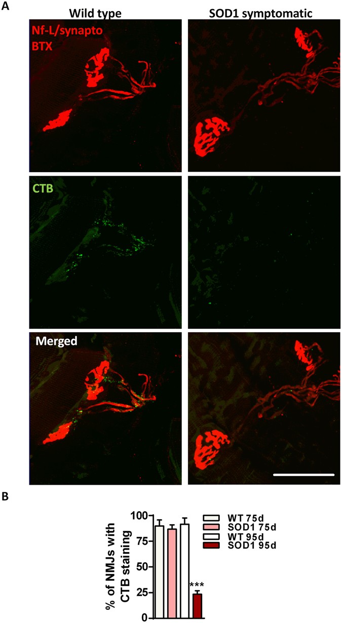 Inhibition Of β Glucocerebrosidase Activity Preserves Motor