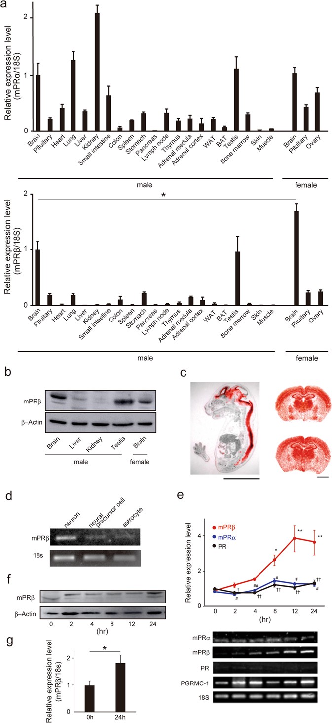 Membrane progesterone receptor beta (mPRβ/Paqr8) promotes  progesterone-dependent neurite outgrowth in PC12 neuronal cells via non-G  protein-coupled receptor (GPCR) signaling | Scientific Reports, image size:675x1464