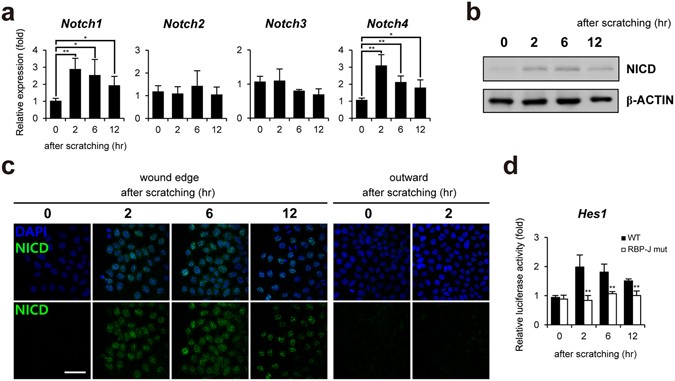 Jmjd3 And Nf Kb Dependent Activation Of Notch1 Gene Is Required For Keratinocyte Migration During Skin Wound Healing Scientific Reports