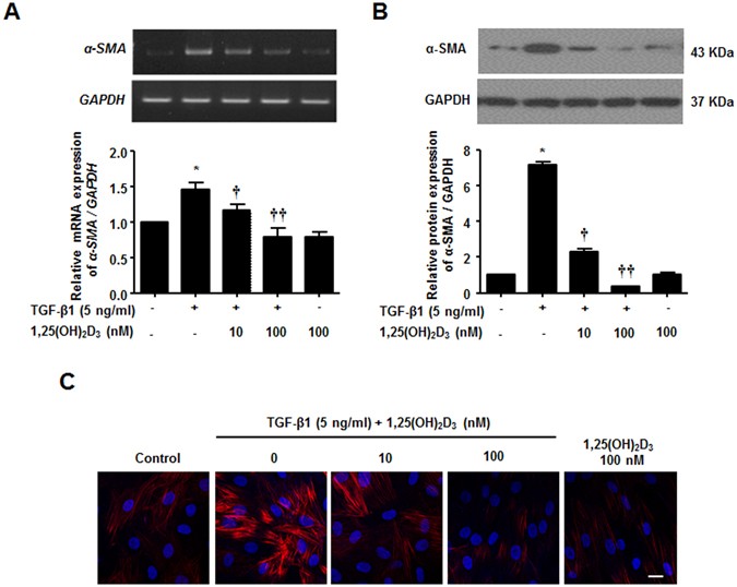 Vitamin D Attenuates Myofibroblast Differentiation And