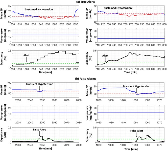 Pressors Chart