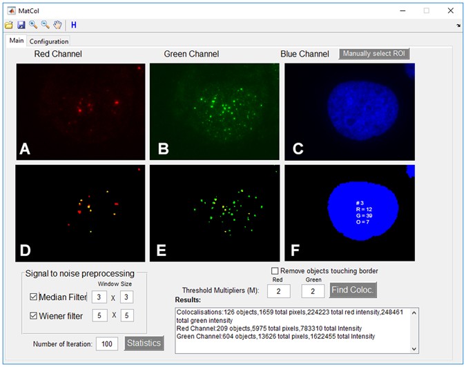 Matcol A Tool To Measure Fluorescence Signal Colocalisation