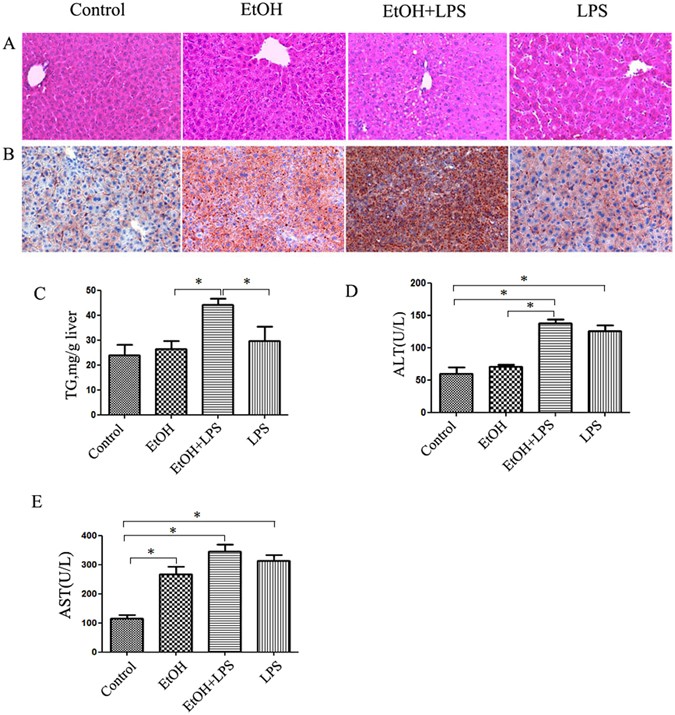 Activation of autophagy attenuates EtOH-LPS-induced hepatic steatosis and  injury through MD2 associated TLR4 signaling | Scientific Reports