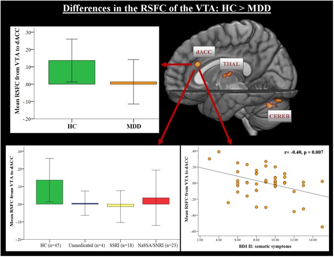 Treatment Associated Changes Of Functional Connectivity Of Midbrain Brainstem Nuclei In Major Depressive Disorder Scientific Reports Treatment Associated Changes Of Functional Connectivity Of Midbrain Brainstem Nuclei In Major Depressive Disorder Scientific Reports