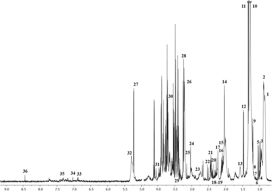 Serum and urine 1H NMR-based metabolomics in the diagnosis of selected  thyroid diseases | Scientific Reports