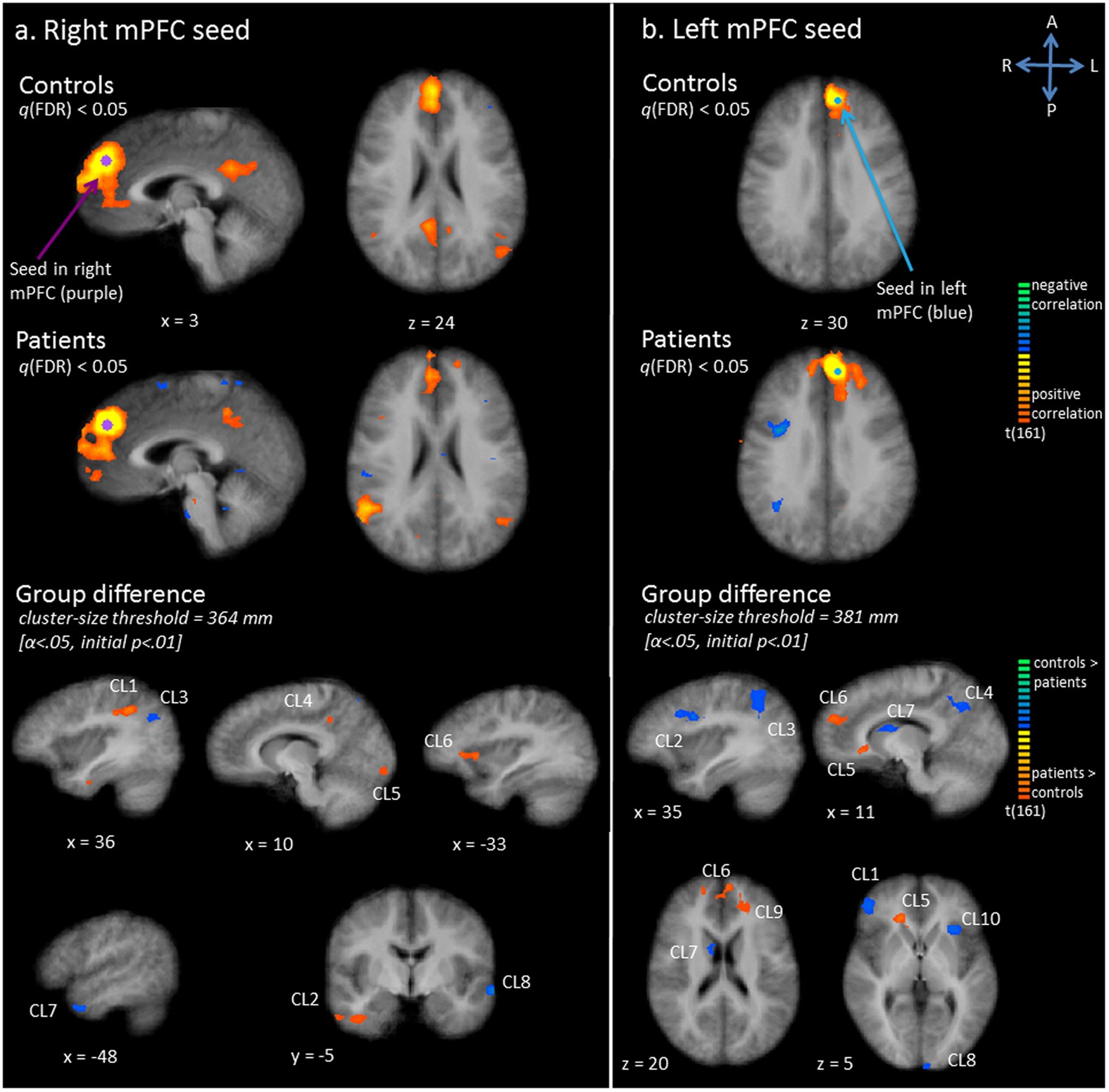 Exploration Of The Brain In Rest Resting State Functional Mri Abnormalities In Patients With Classic Galactosemia Scientific Reports Exploration Of The Brain In Rest Resting State Functional Mri Abnormalities In Patients With Classic Galactosemia Scientific Reports