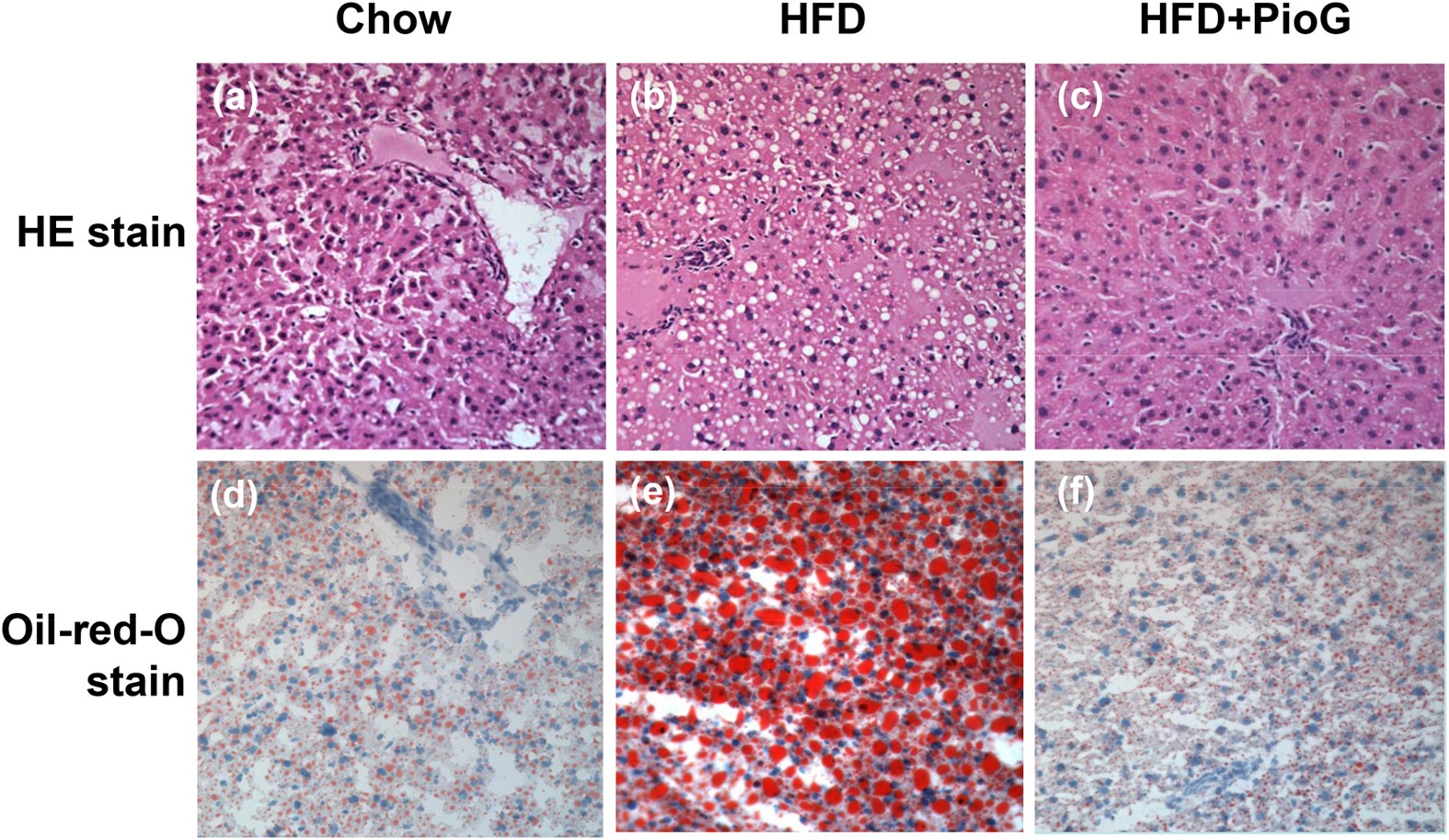 Pioglitazone Enhances Cytosolic Lipolysis B Oxidation And Autophagy To Ameliorate Hepatic Steatosis Scientific Reports