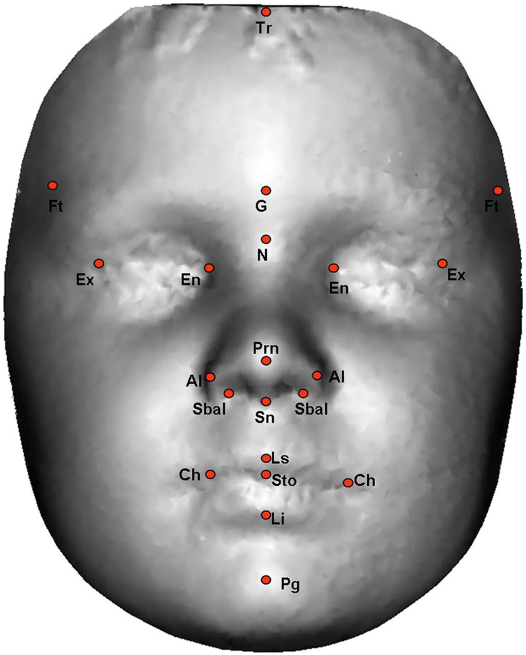 Autistic Features Linked To Prenatal >> Hypermasculinised Facial Morphology In Boys And Girls With Autism Autistic Features Linked To Prenatal >> Hypermasculinised Facial Morphology In Boys And Girls With Autism