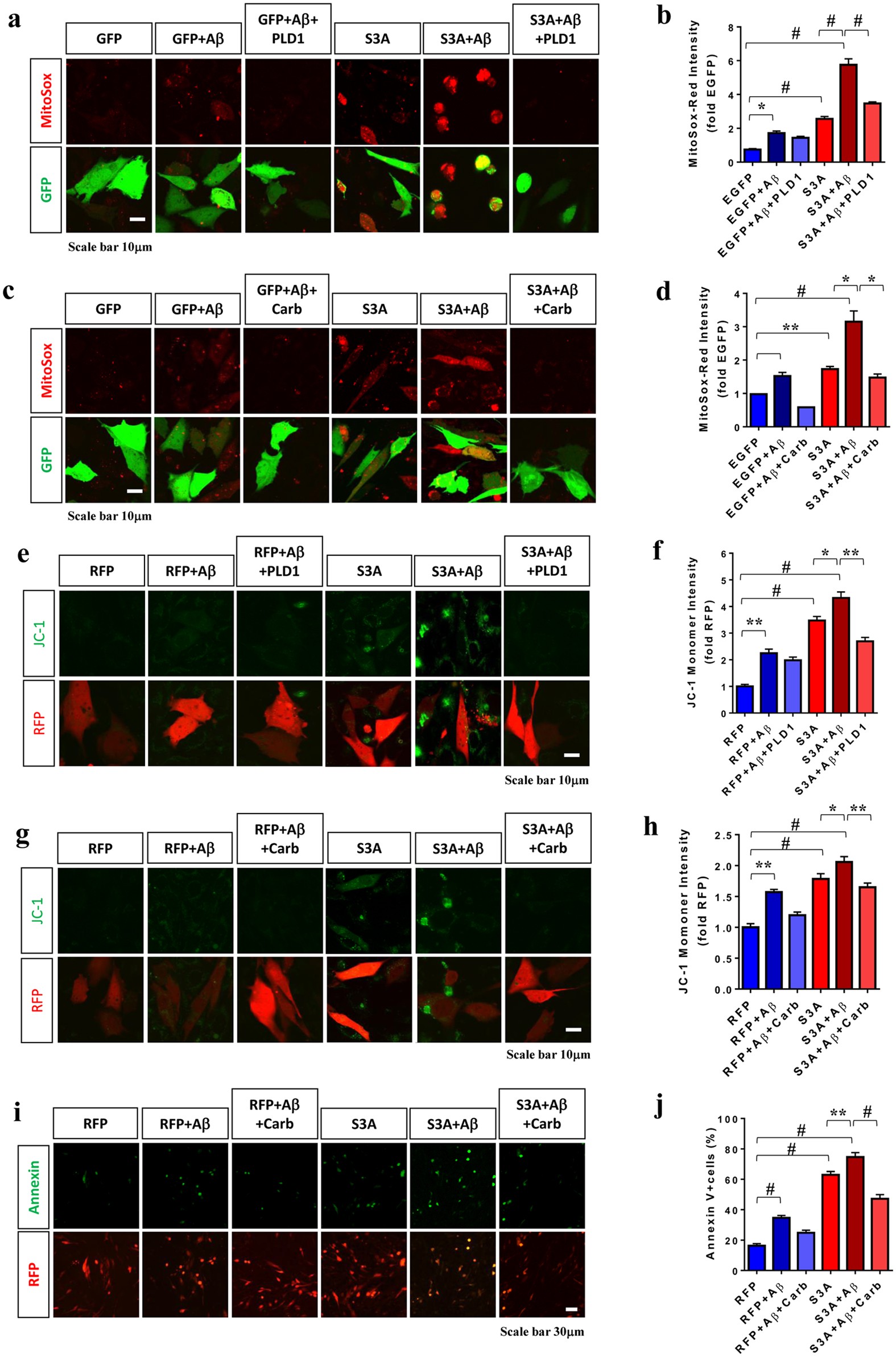 Cofilin-mediated Neuronal Apoptosis via p53 Translocation and PLD1  Regulation | Scientific Reports