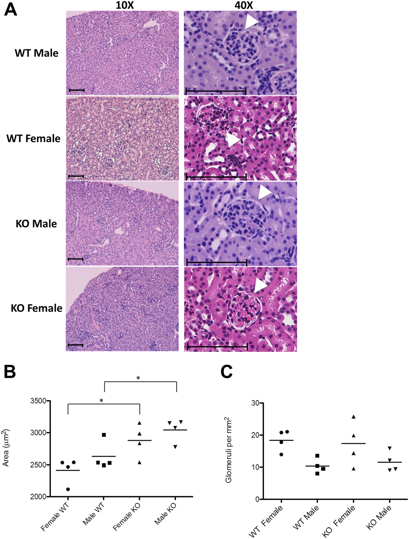 Mitochondrial Cyclophilin D Ablation Is Associated With The