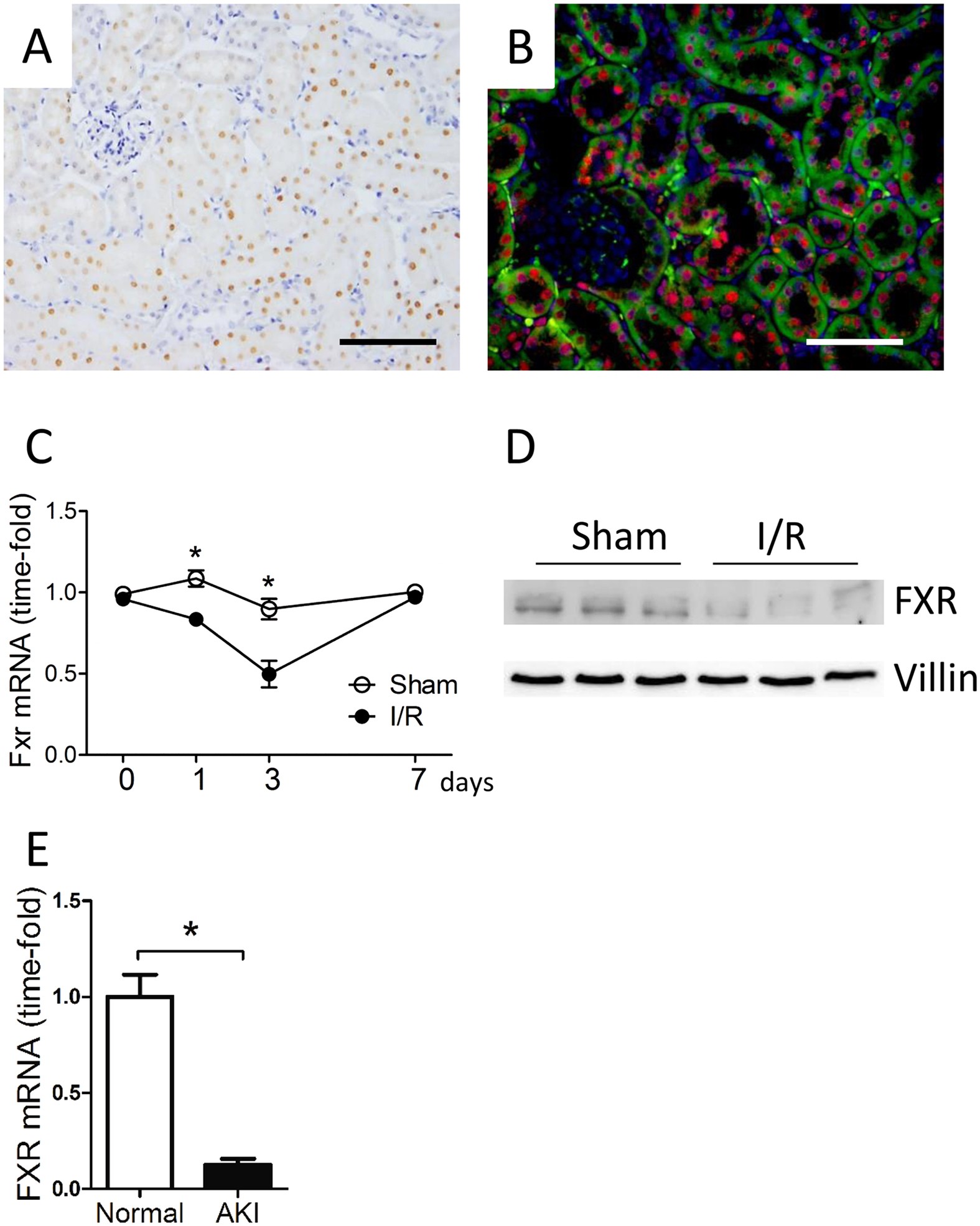 Farnesoid X receptor activation protects the kidney from ischemia-reperfusion damage | Scientific Reports