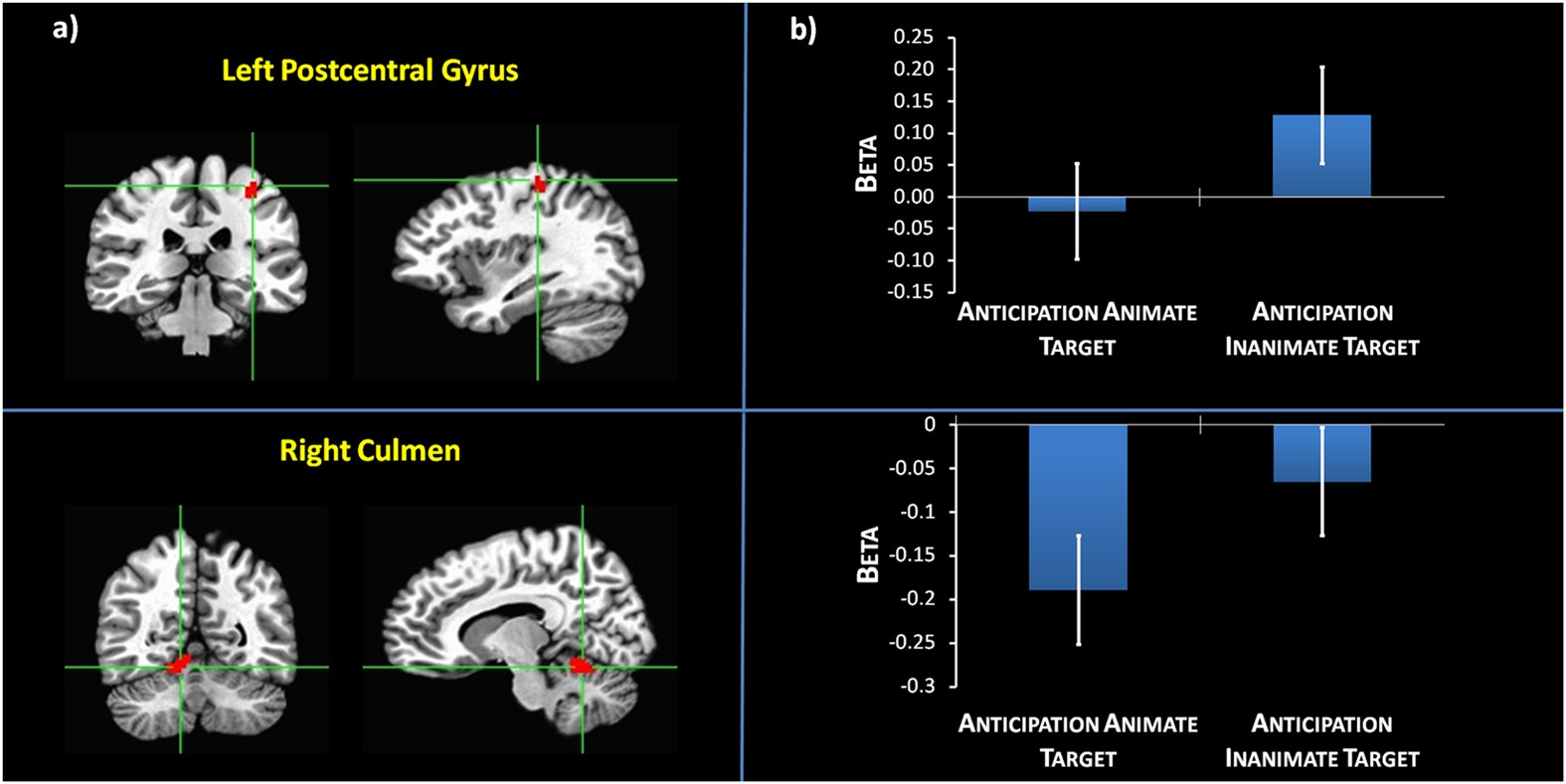 How Spontaneous Brain Activity And Narcissistic Features Shape Social Interaction Scientific Reports How Spontaneous Brain Activity And Narcissistic Features Shape Social Interaction Scientific Reports