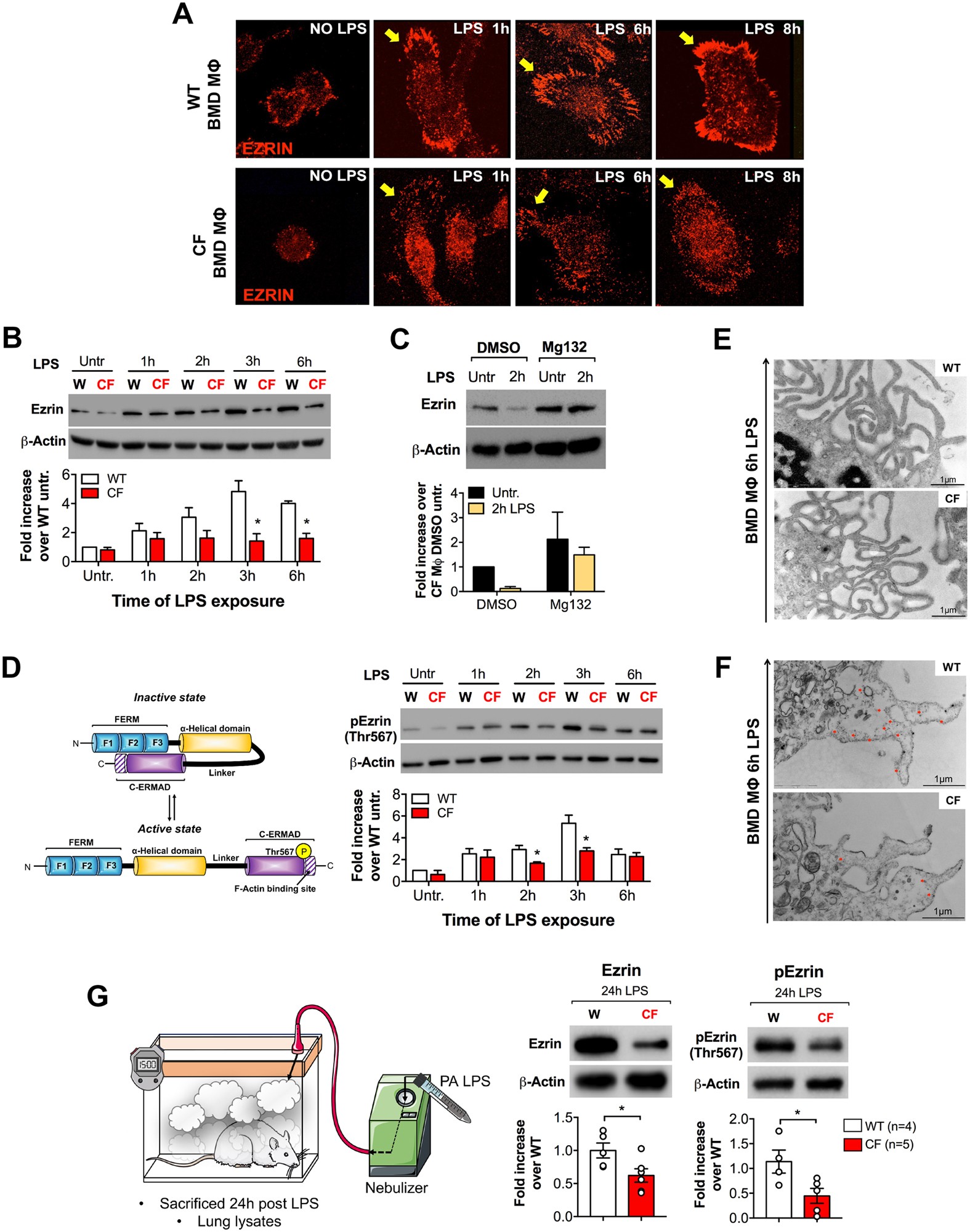 Ezrin Links Cftr To Tlr4 Signaling To Orchestrate Anti Bacterial Immune Response In Macrophages Scientific Reports