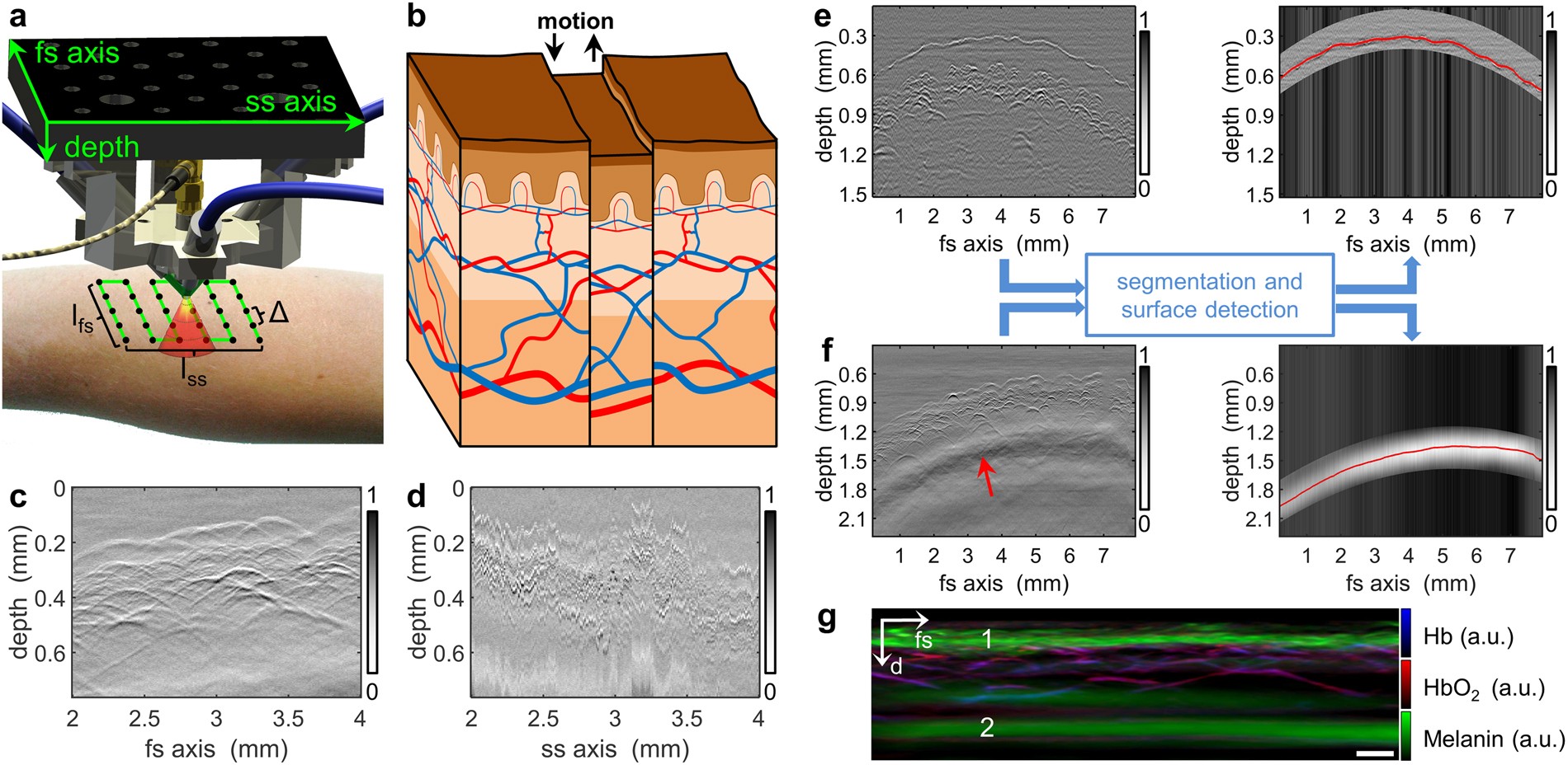 Motion Correction In Optoacoustic Mesoscopy Scientific Reports