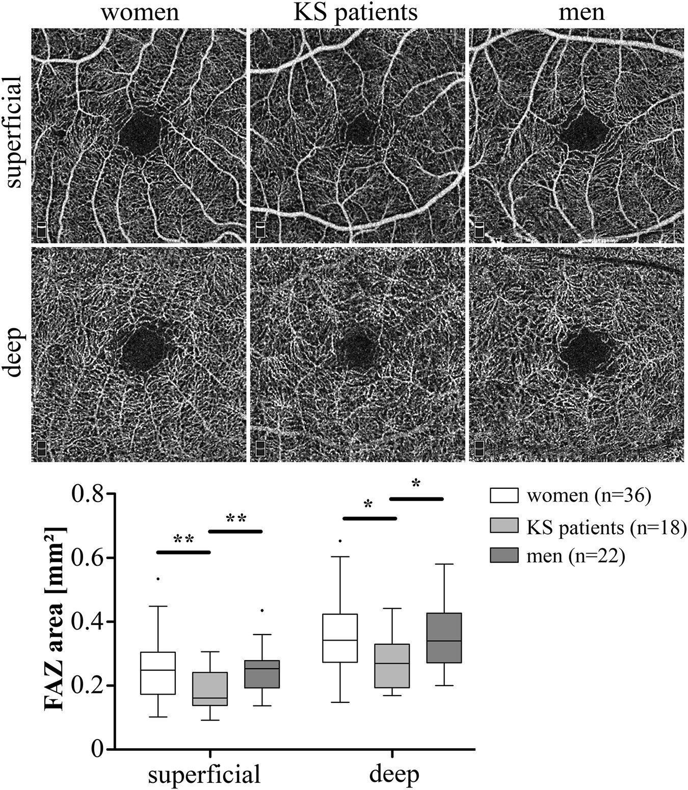 Aberrant ocular architecture and function in patients with Klinefelter  syndrome | Scientific Reports
