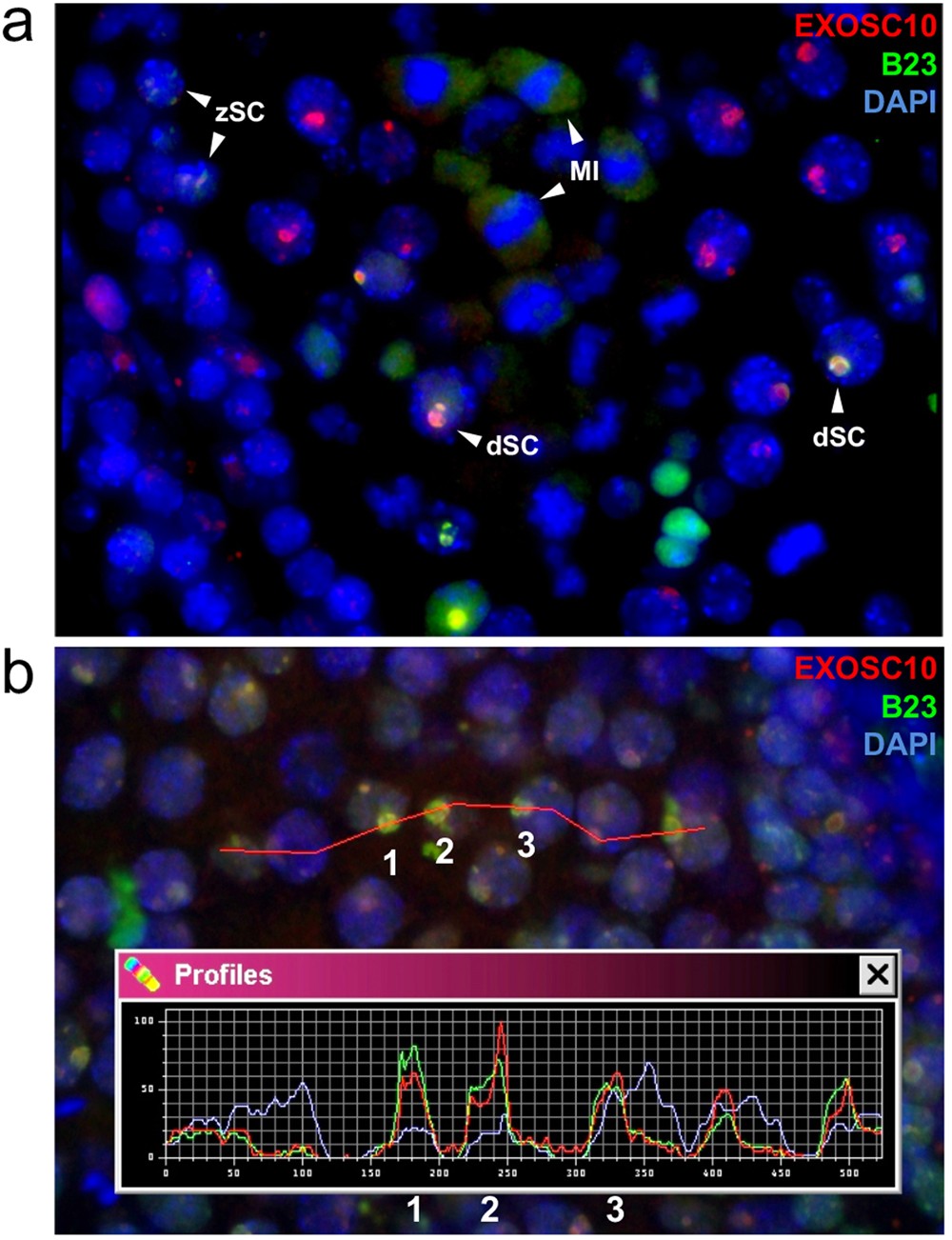 EXOSC10/Rrp6 is post-translationally regulated in male germ cells and  controls the onset of spermatogenesis | Scientific Reports