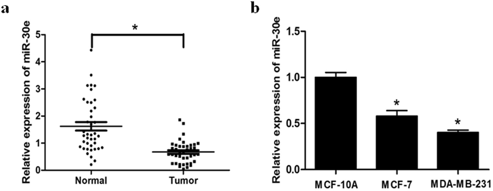 Mir 30e Inhibits Tumor Growth And Chemoresistance Via Targeting Irs1 In Breast Cancer Scientific Reports Mir 30e Inhibits Tumor Growth And Chemoresistance Via Targeting Irs1 In Breast Cancer Scientific Reports