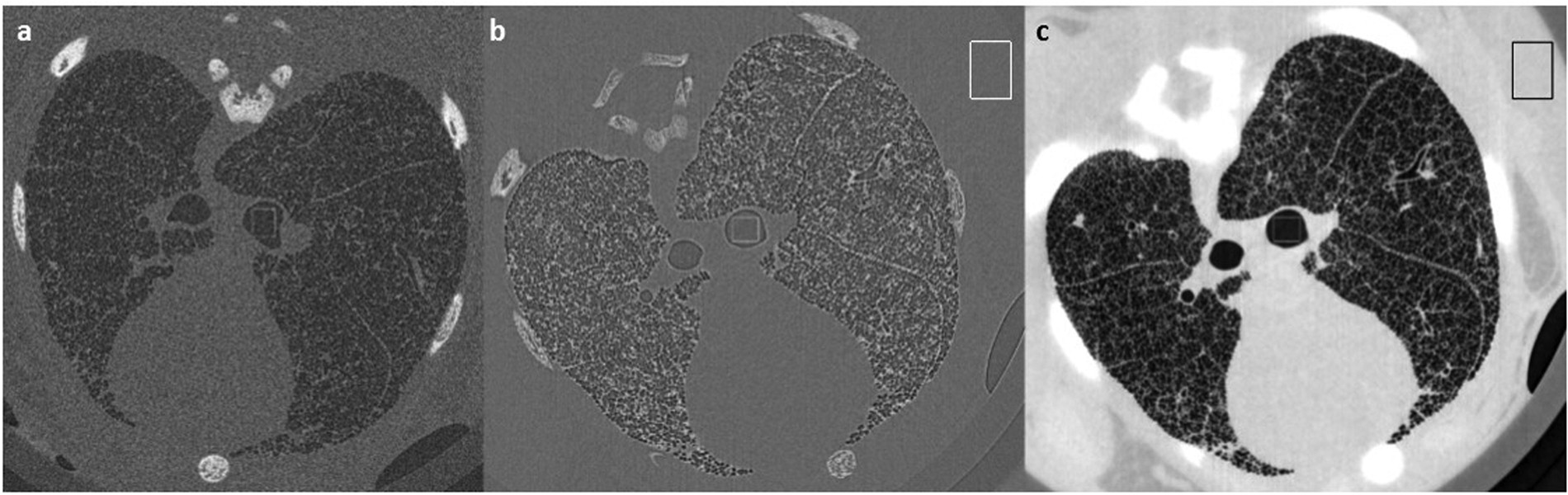 Intrinsic-corrected SPECT images, for EM2, of the Jaszczak phantom with...  | Download Scientific Diagram