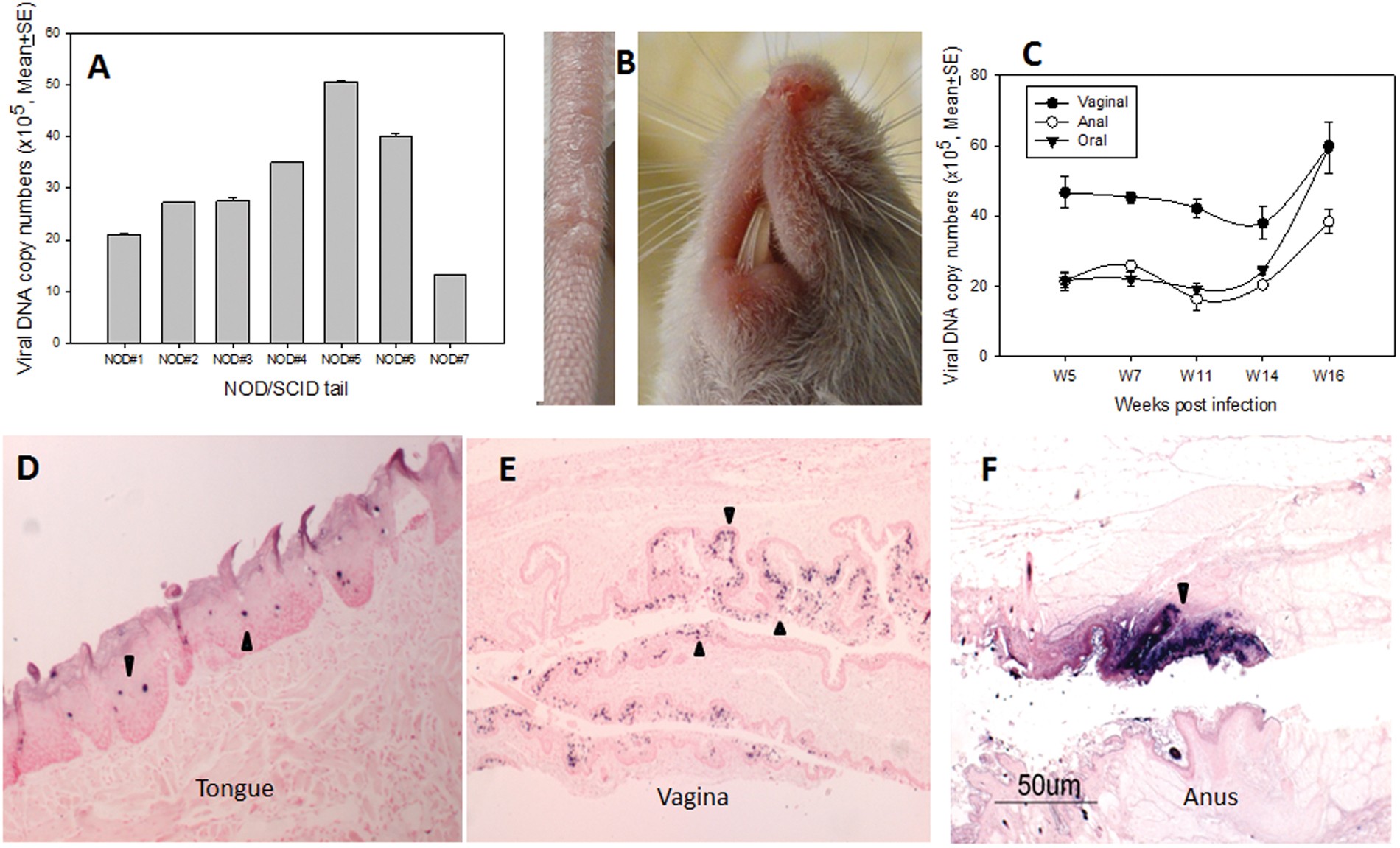 Mouse papillomavirus infection persists in mucosal tissues of an immunocompetent mouse strain and progresses to cancer | Scientific Reports Mouse papillomavirus infection persists in mucosal tissues of an immunocompetent mouse strain and progresses to cancer | Scientific Reports