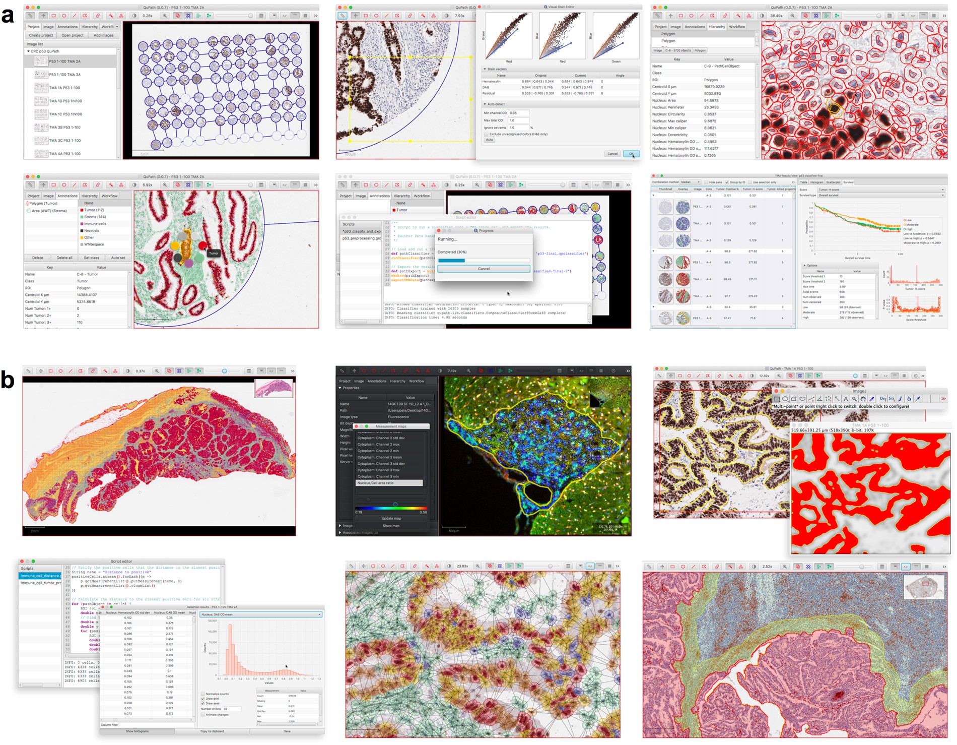Qupath Open Source Software For Digital Pathology Image