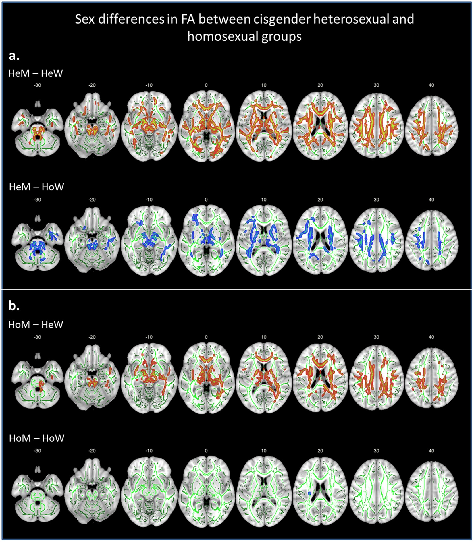 Structural connections in the brain in relation to gender identity and sexual orientation Scientific Reports image