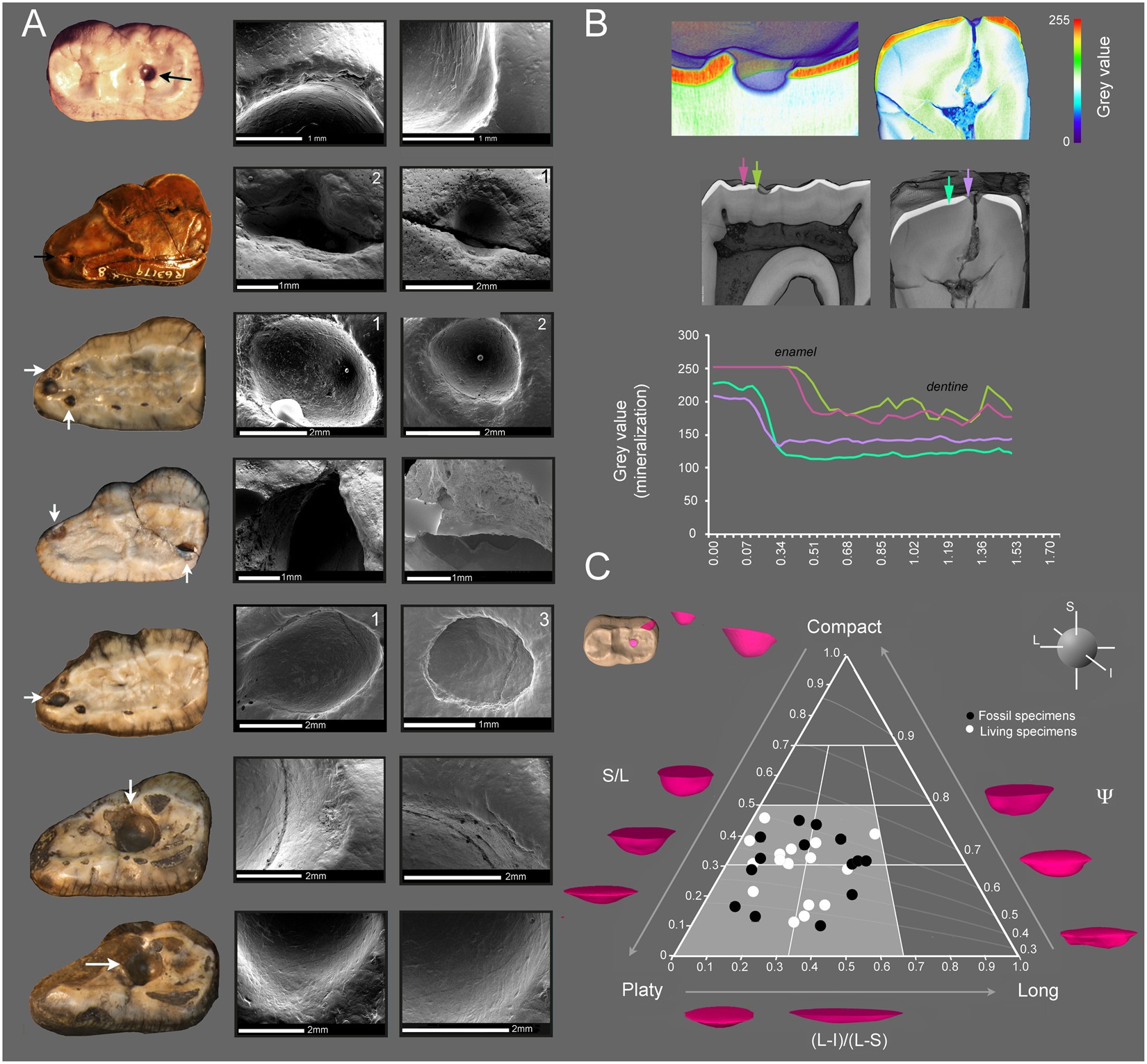 Dental caries in the fossil record: a 