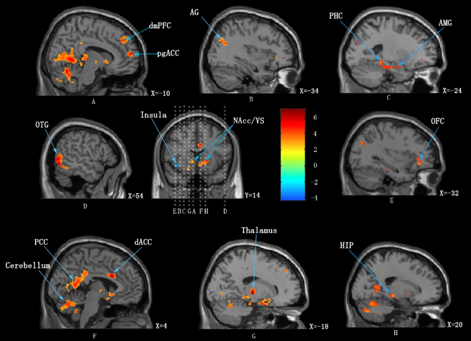 The Neural Correlates Of The Unified Percept Of Alcohol - 
