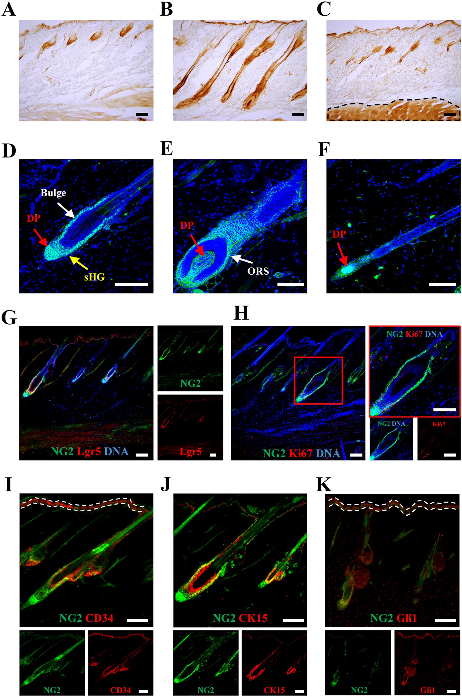 In vivo monitoring of hair cycle stages via bioluminescence imaging of hair  follicle NG2 cells | Scientific Reports