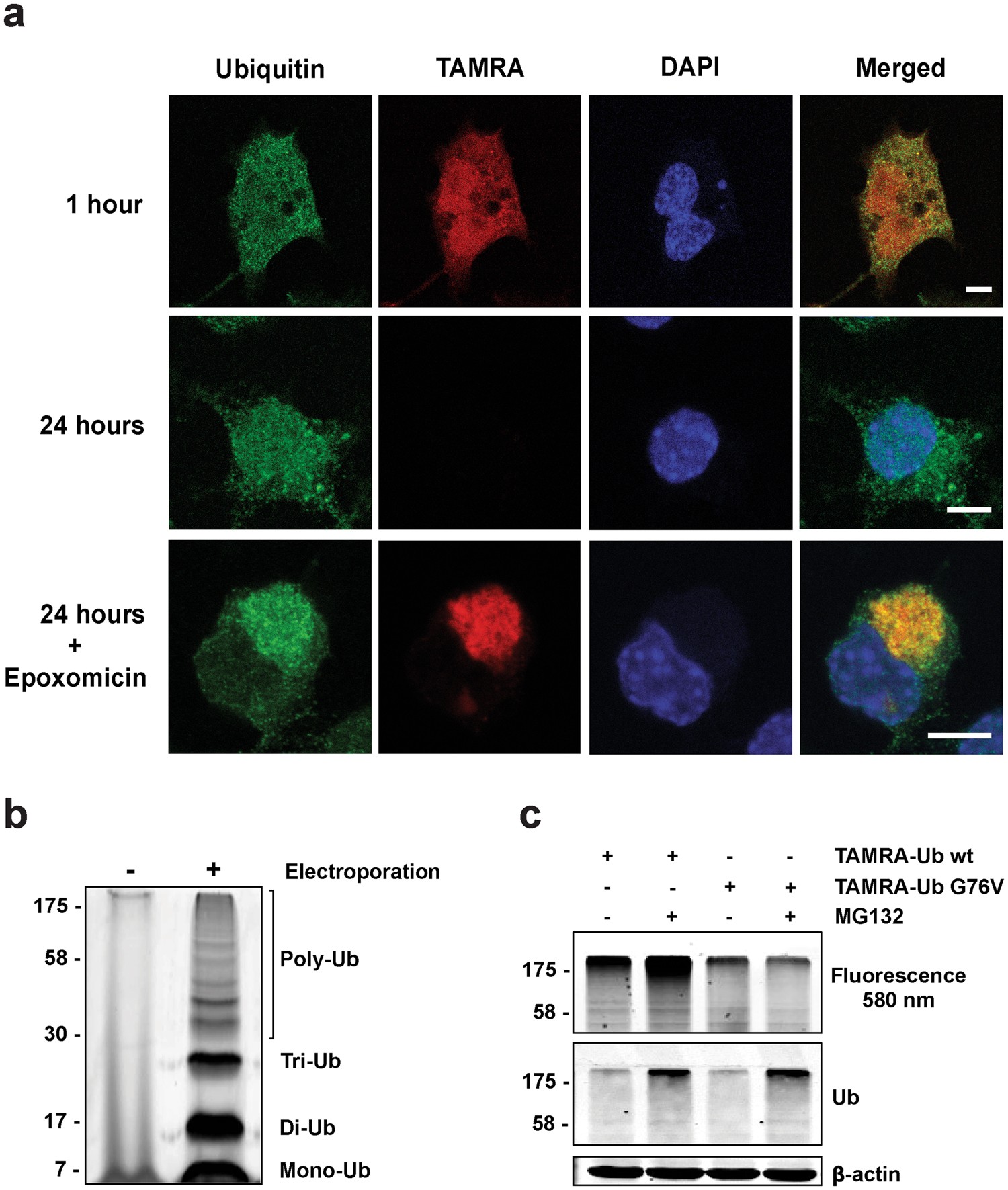 dynamic recruitment of ubiquitin