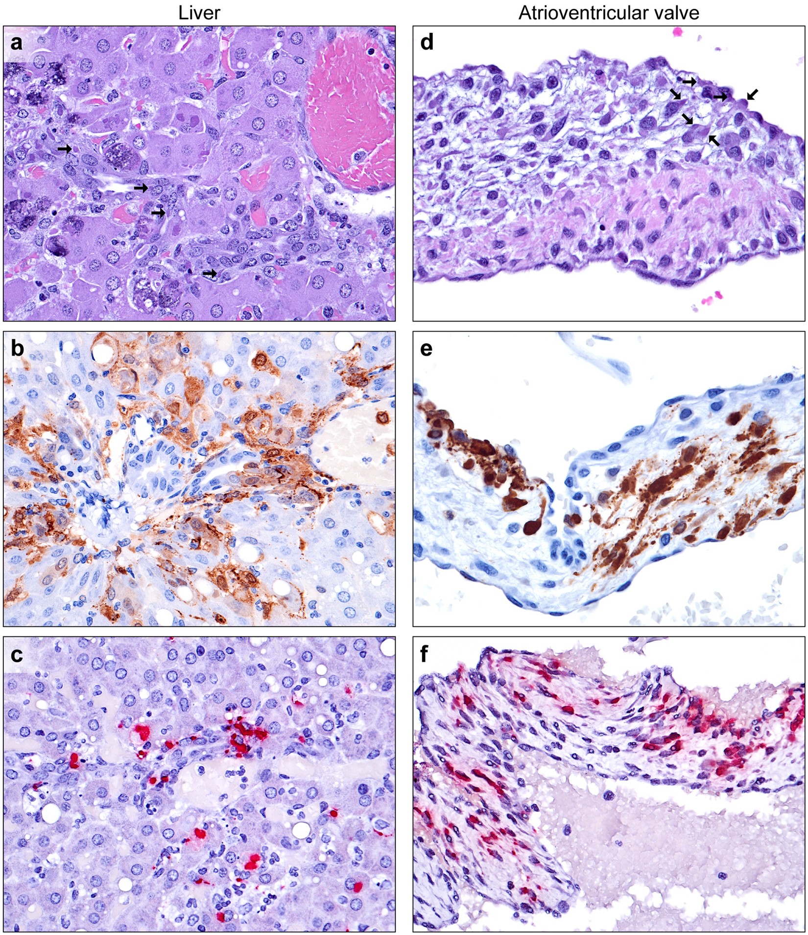 Basophilic viral inclusion body in the nucleus of a hepatocyte of