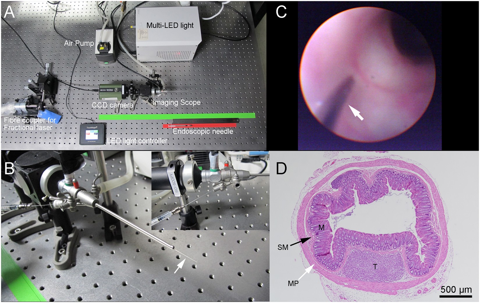 Endoscopic non-ablative fractional laser therapy in an orthotopic colon  tumour model | Scientific Reports