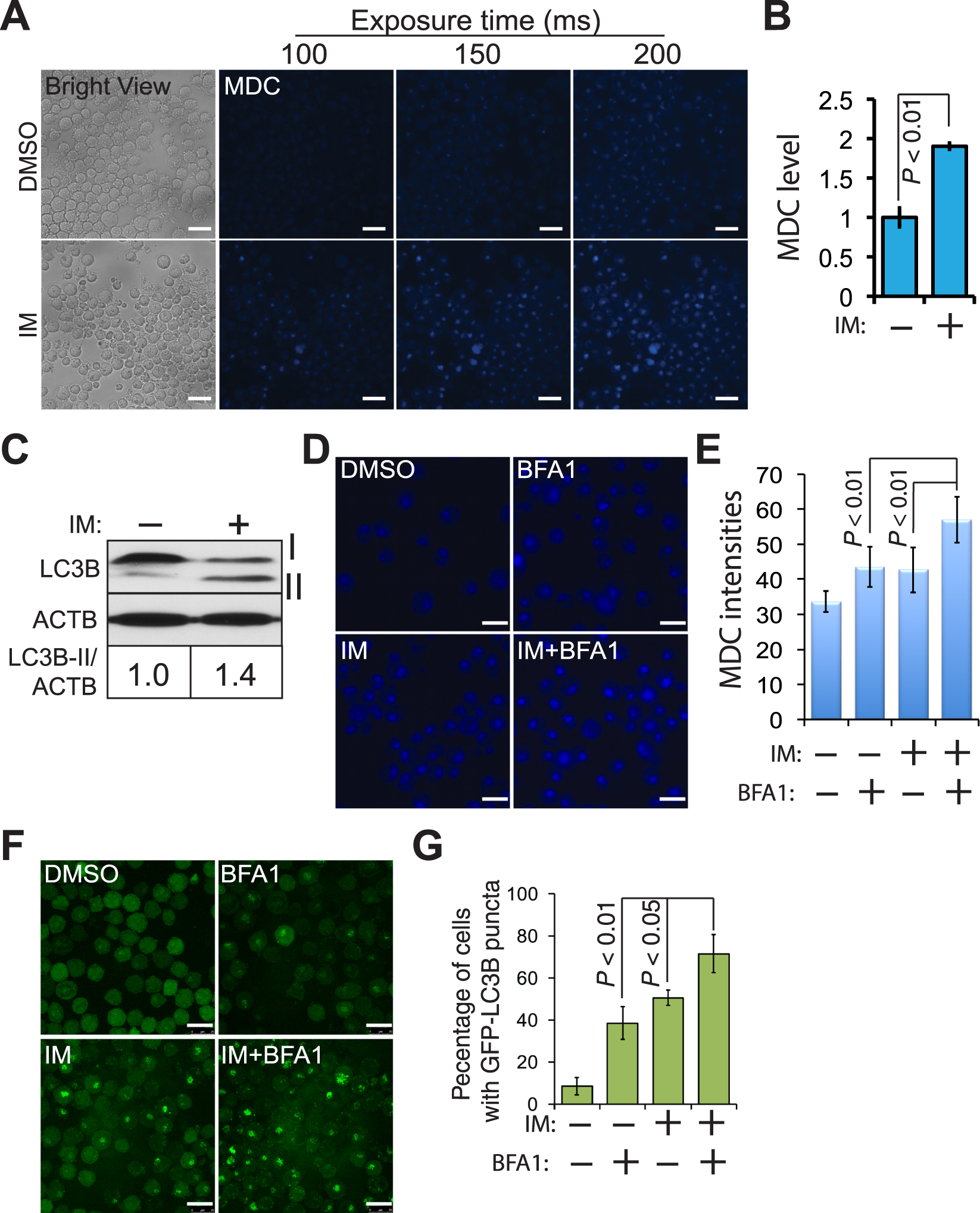 A Large Scale Rna Interference Screen Identifies Genes That Regulate Autophagy At Different Stages Scientific Reports A Large Scale Rna Interference Screen Identifies Genes That Regulate Autophagy At Different Stages Scientific Reports