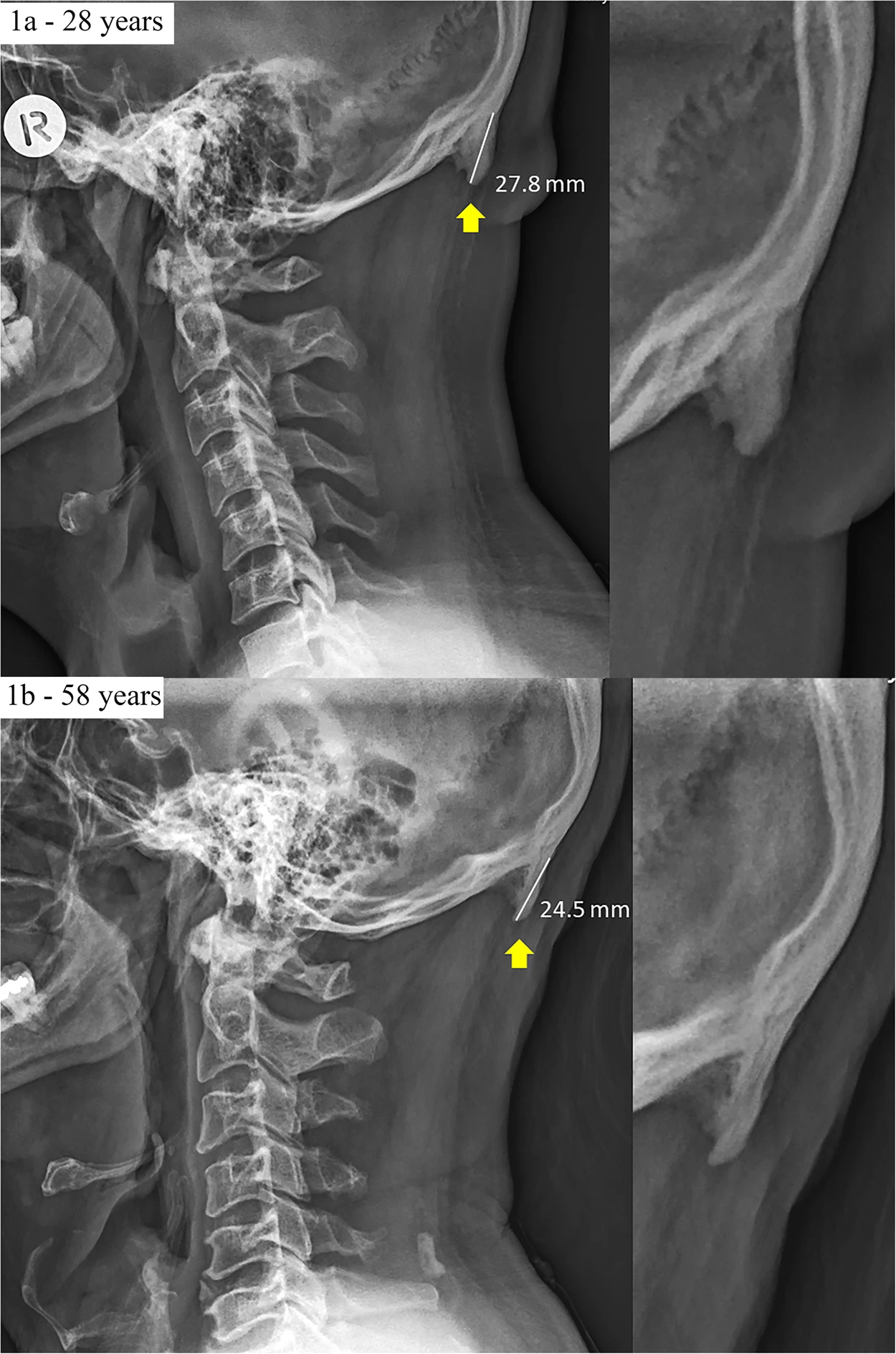 https://media.springernature.com/full/springer-static/image/art%3A10.1038%2Fs41598-018-21625-1/MediaObjects/41598_2018_21625_Fig1_HTML.jpg?as=webp