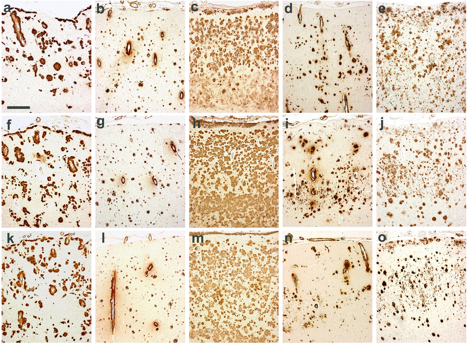 molecular subtypes of alzheimers disease scientific reports form it 112 r