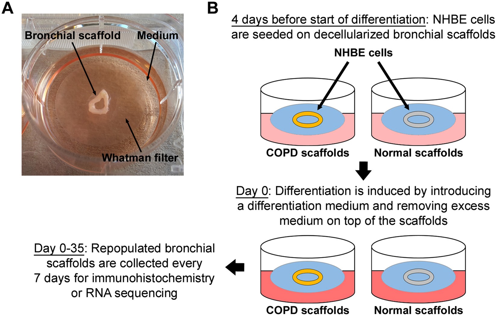 Bronchial extracellular matrix from COPD patients induces altered gene expression in primary human bronchial epithelial cells | Scientific Reports