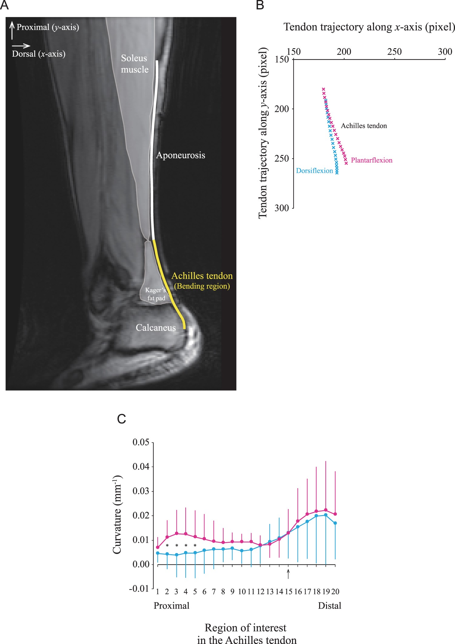 A Multi-modality Approach Towards Elucidation of the Mechanism for Human  Achilles Tendon Bending During Passive Ankle Rotation | Scientific Reports