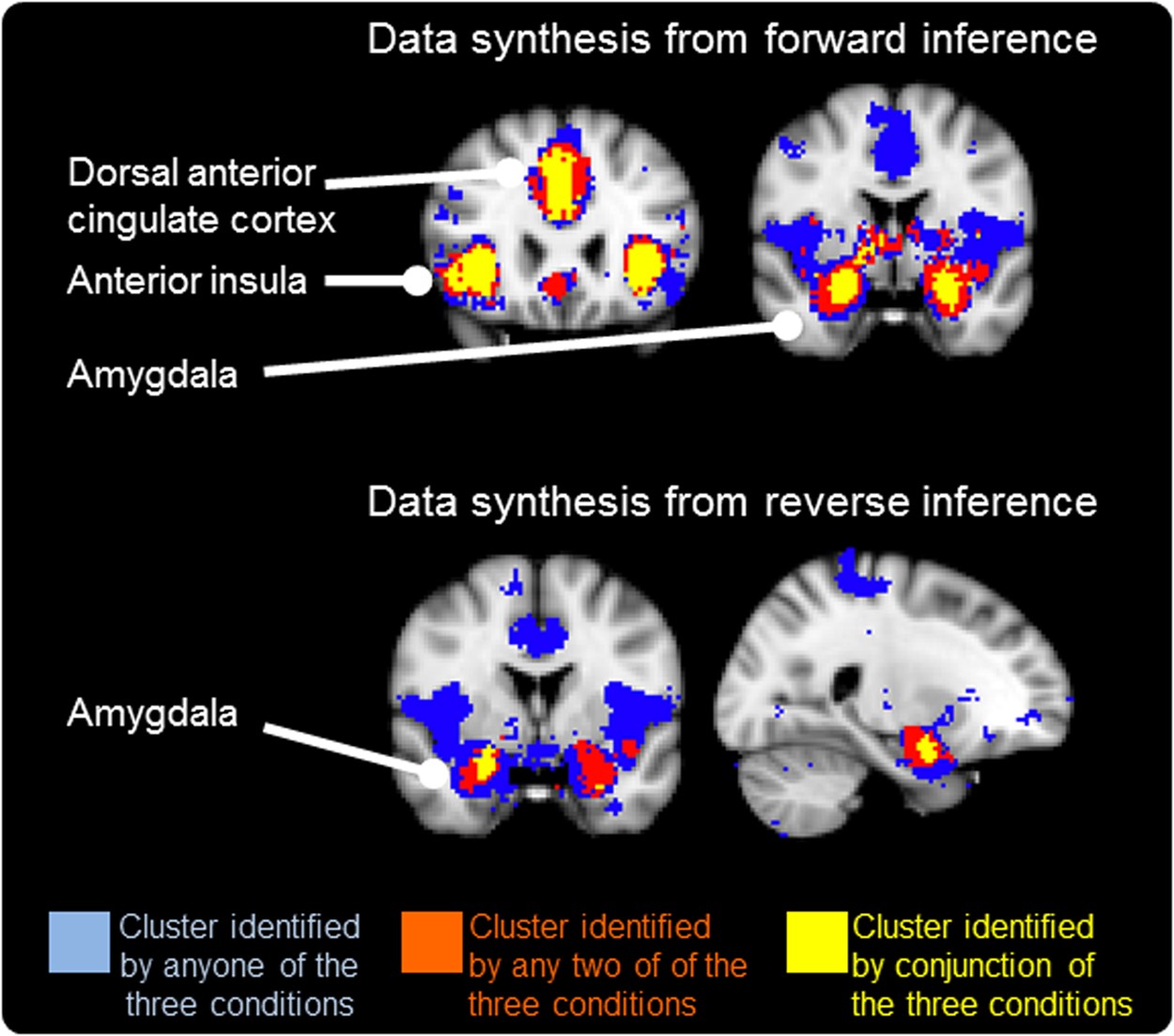 Brain activations associated with fearful experience show common and  distinct patterns between younger and older adults in the hippocampus and  the amygdala | Scientific Reports