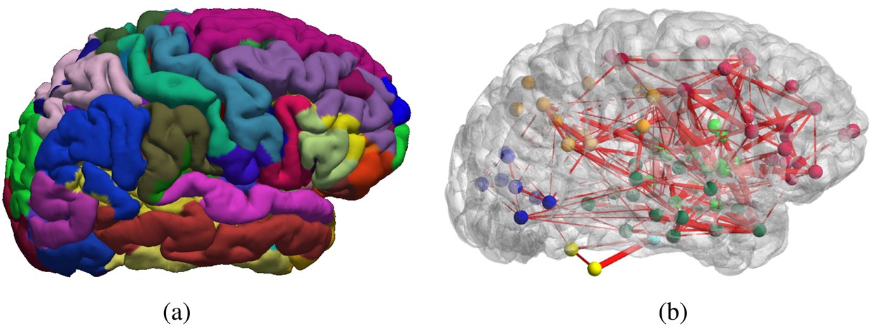 Function Specific And Enhanced Brain Structural Connectivity