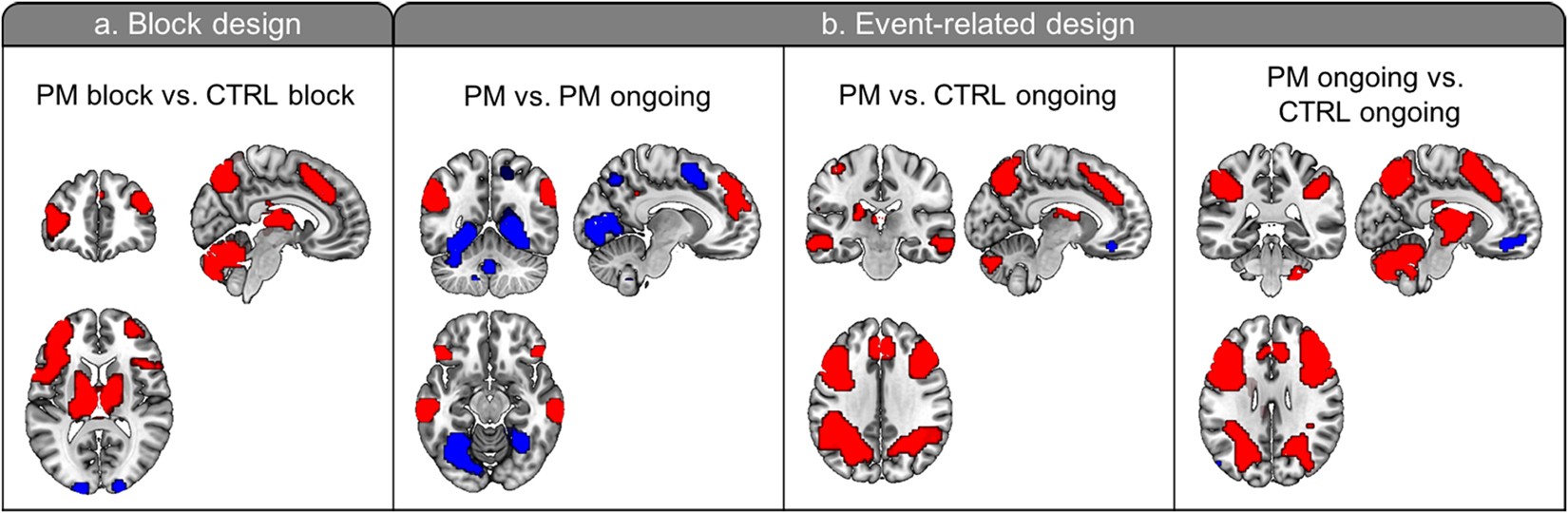 Disturbed retrieval network and prospective memory decline in postpartum  women | Scientific Reports