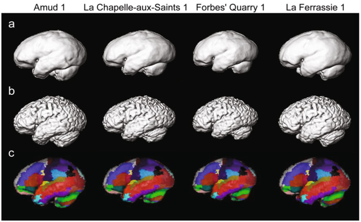 Image of the Day: Brains and Braincases