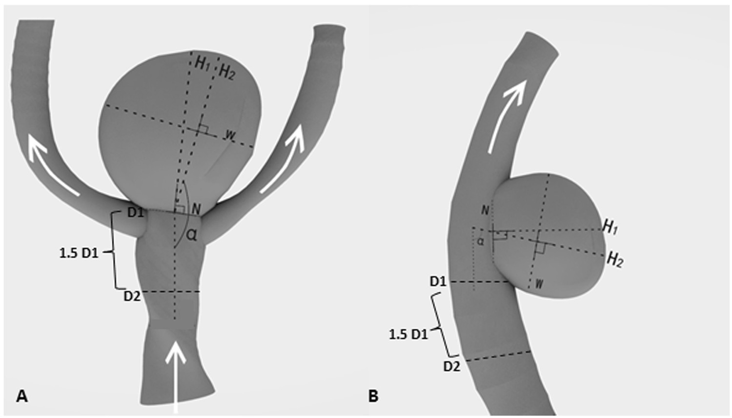 Morphological parameters and anatomical locations associated with rupture  status of small intracranial aneurysms | Scientific Reports