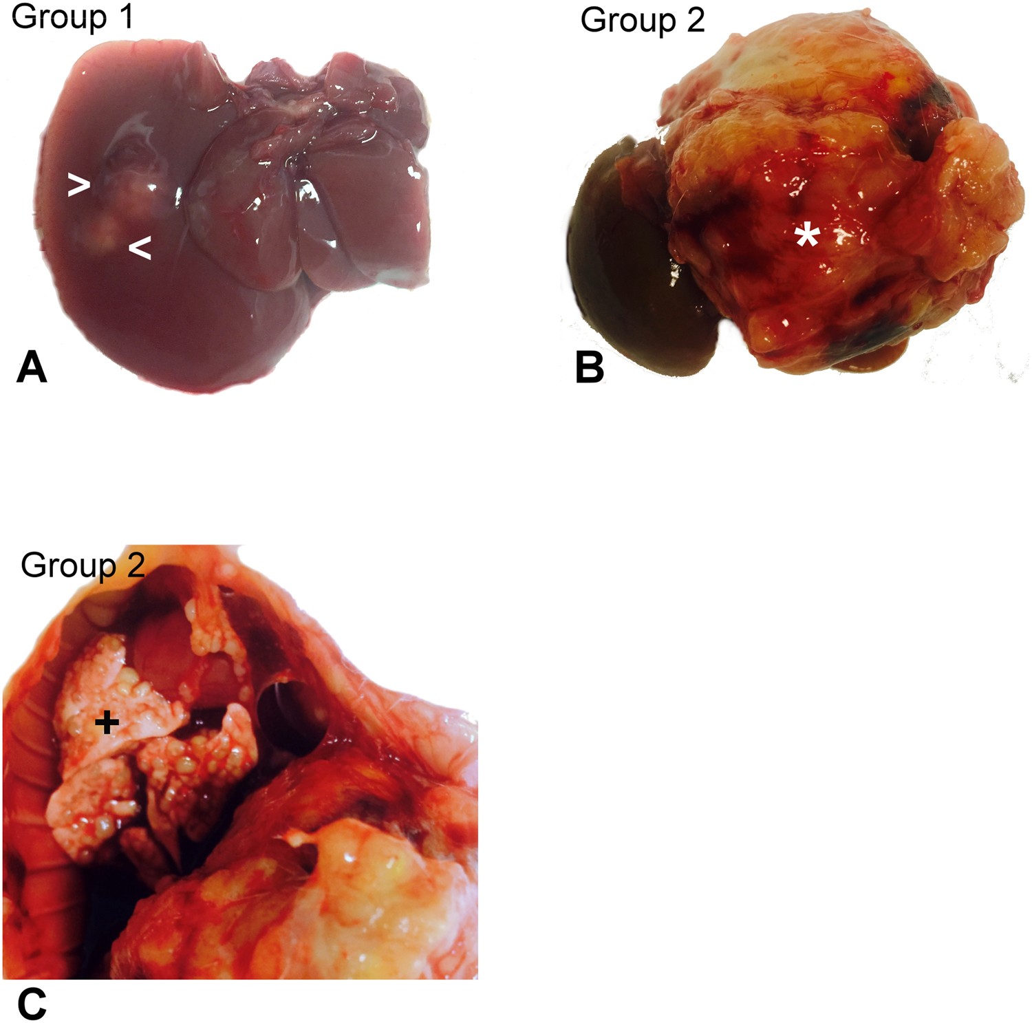 Role Of Kupffer Cells In The Progression Of Crc Liver Metastases After The  First Stage Of Alpps | Scientific Reports