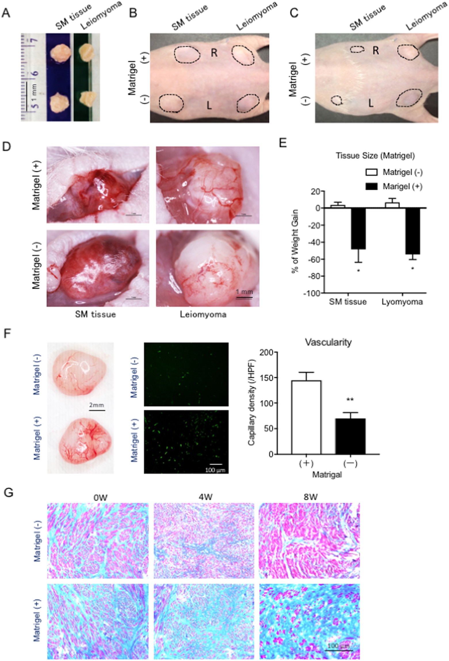 Establishment of a novel mouse xenograft model of human uterine leiomyoma |  Scientific Reports