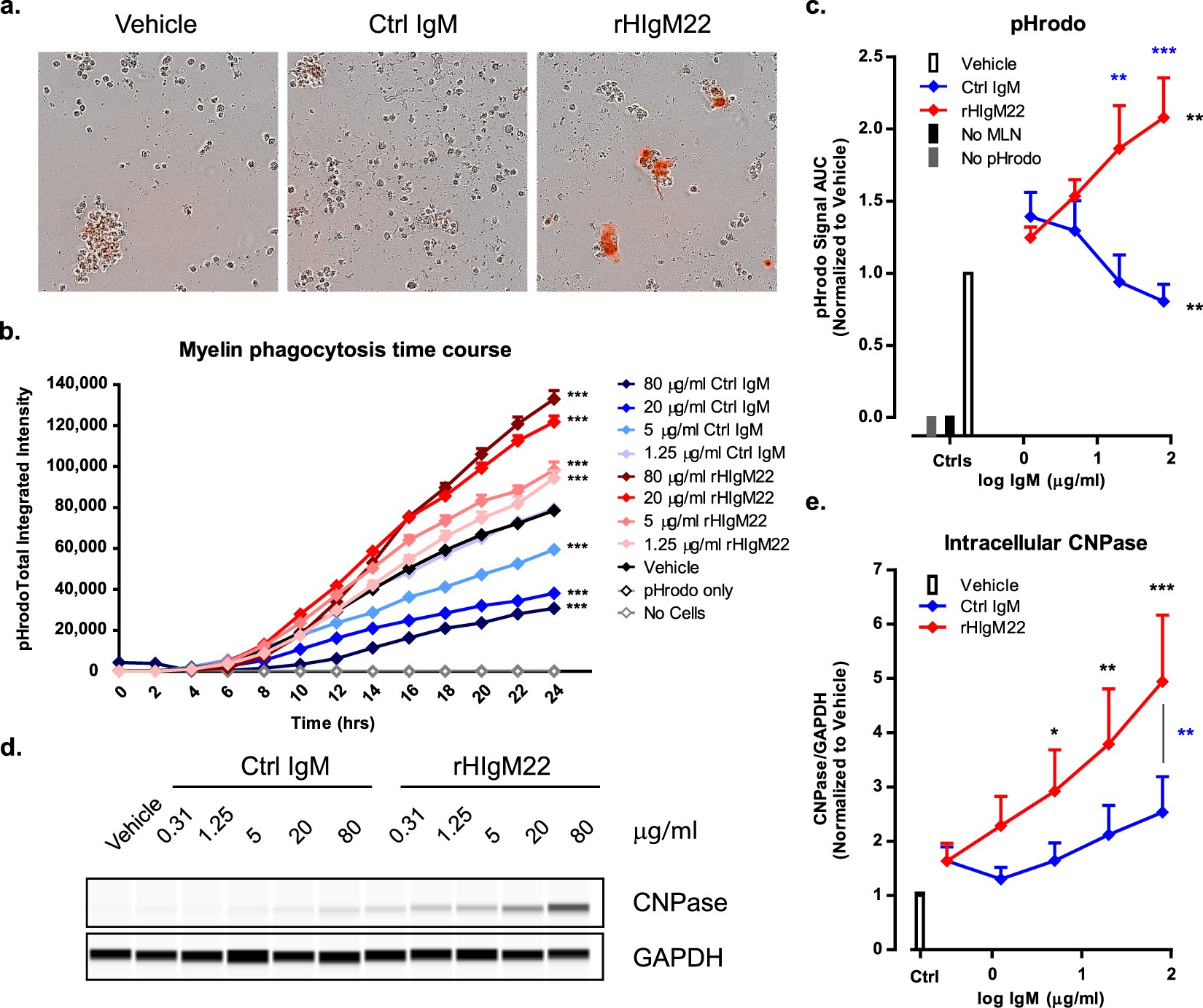 Human Igm Antibody Rhigm22 Promotes Phagocytic Clearance Of Myelin Human Igm Antibody Rhigm22 Promotes Phagocytic Clearance Of Myelin
