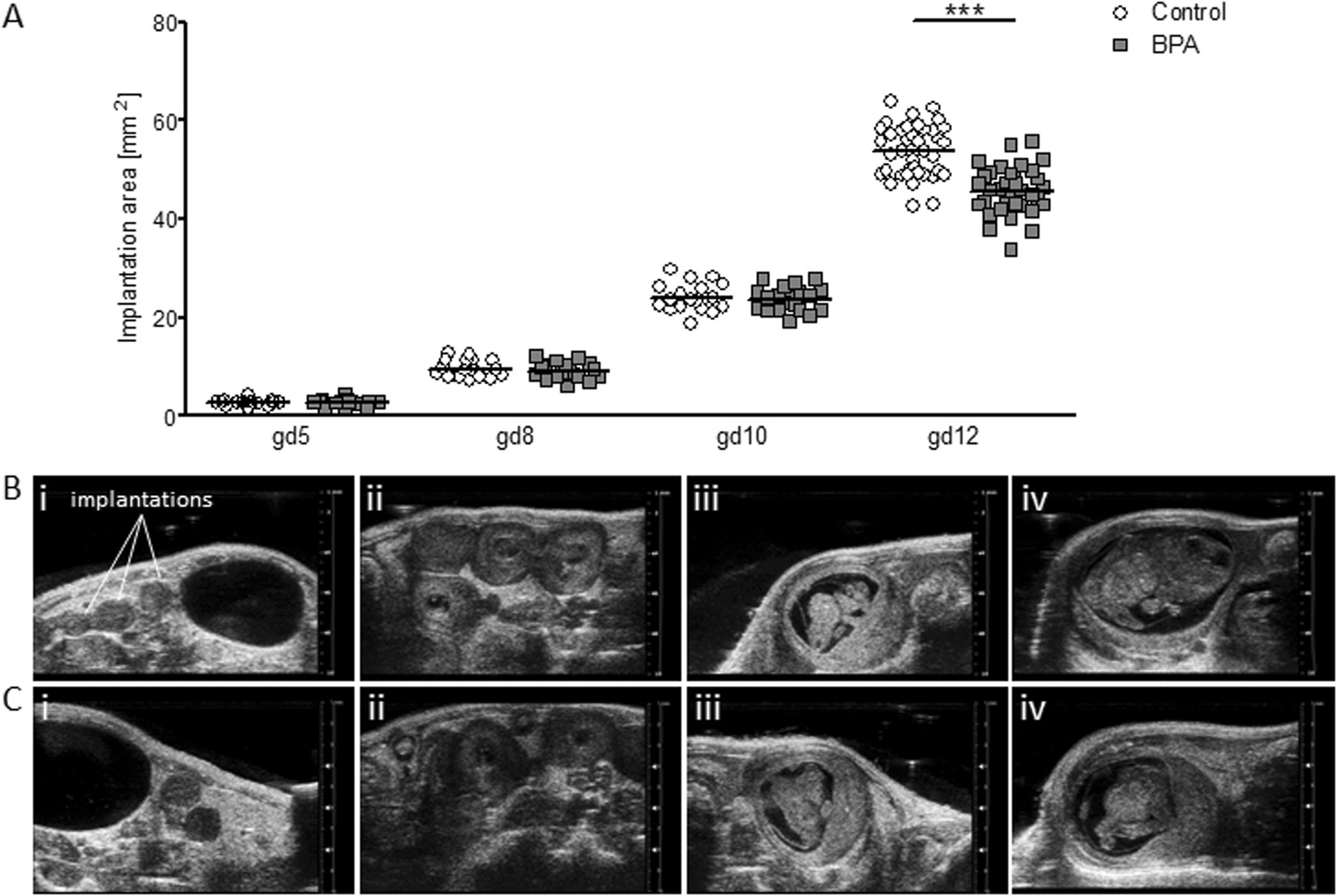 Direct Evidence Of Exposure Of Pregnant >> Bisphenol A Exposure During Early Pregnancy Impairs Uterine Spiral Direct Evidence Of Exposure Of Pregnant >> Bisphenol A Exposure During Early Pregnancy Impairs Uterine Spiral
