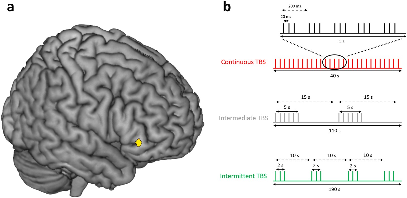 human brain mapping bu cas