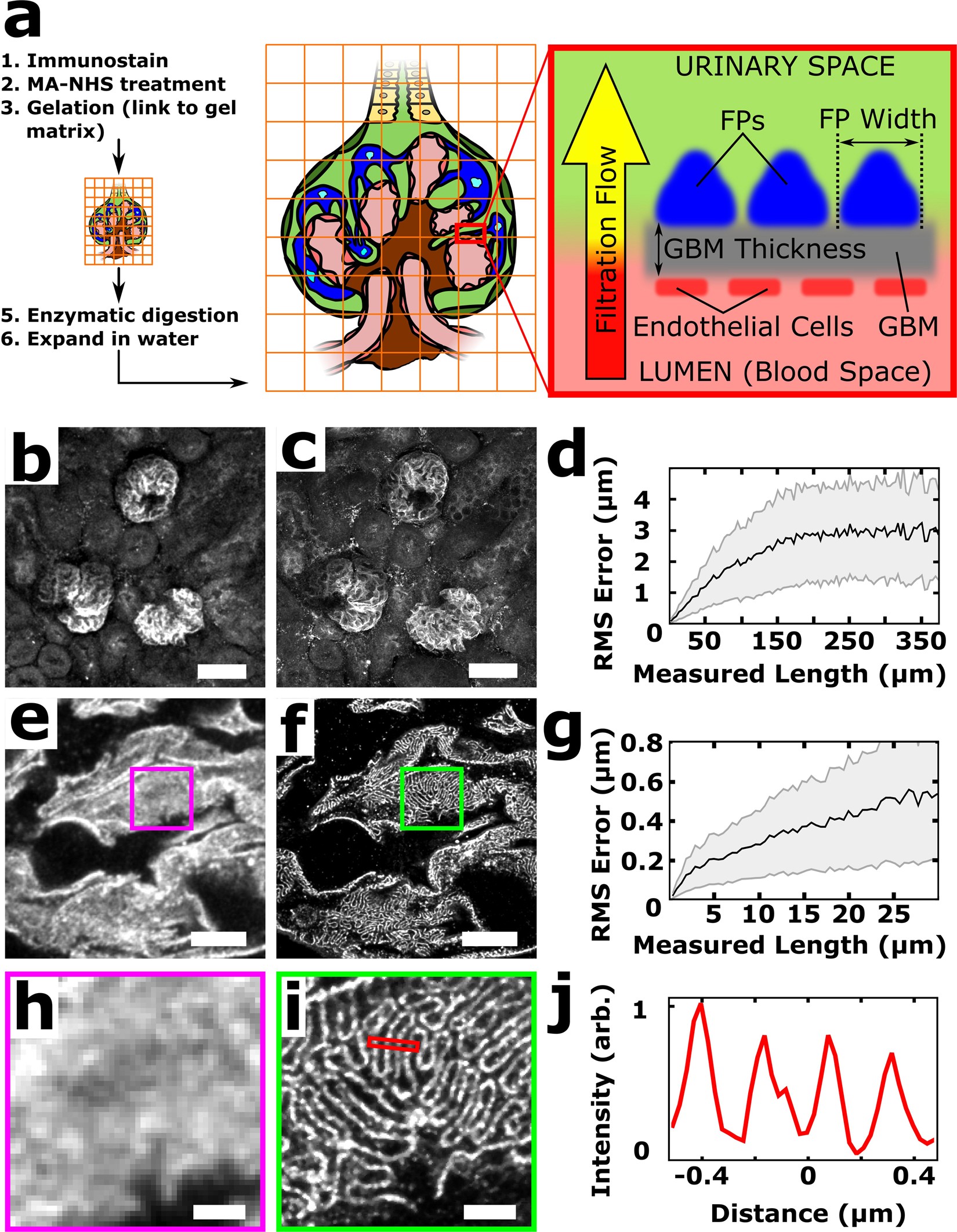 Imaging Approaches Expand View Into >> Volumetric Nanoscale Optical Imaging Of Mouse And Human Kidney Via Imaging Approaches Expand View Into >> Volumetric Nanoscale Optical Imaging Of Mouse And Human Kidney Via