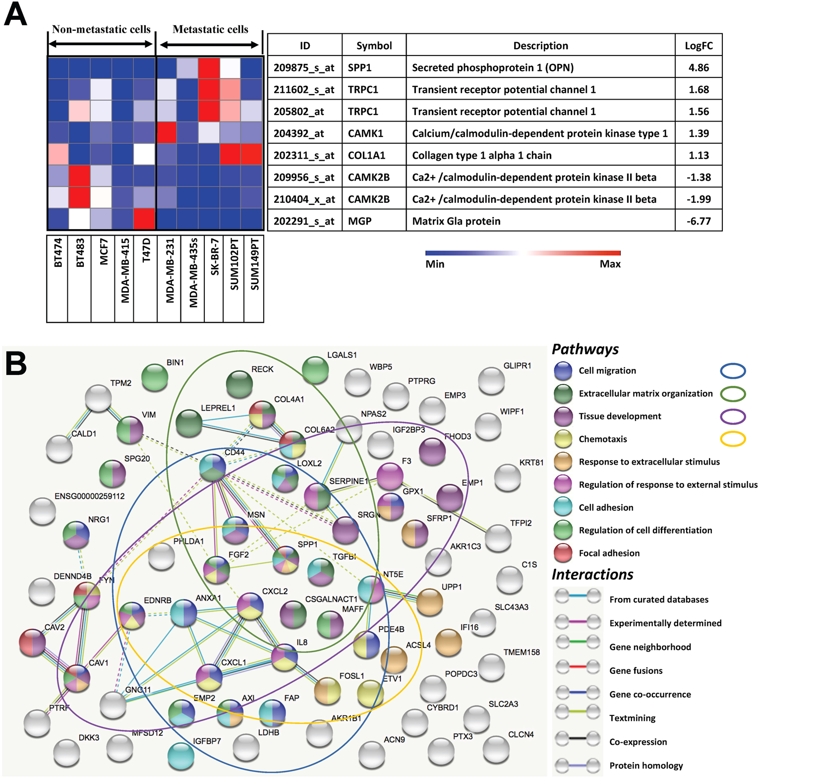 Mapping the genetic basis of breast microcalcifications and their role in  metastasis