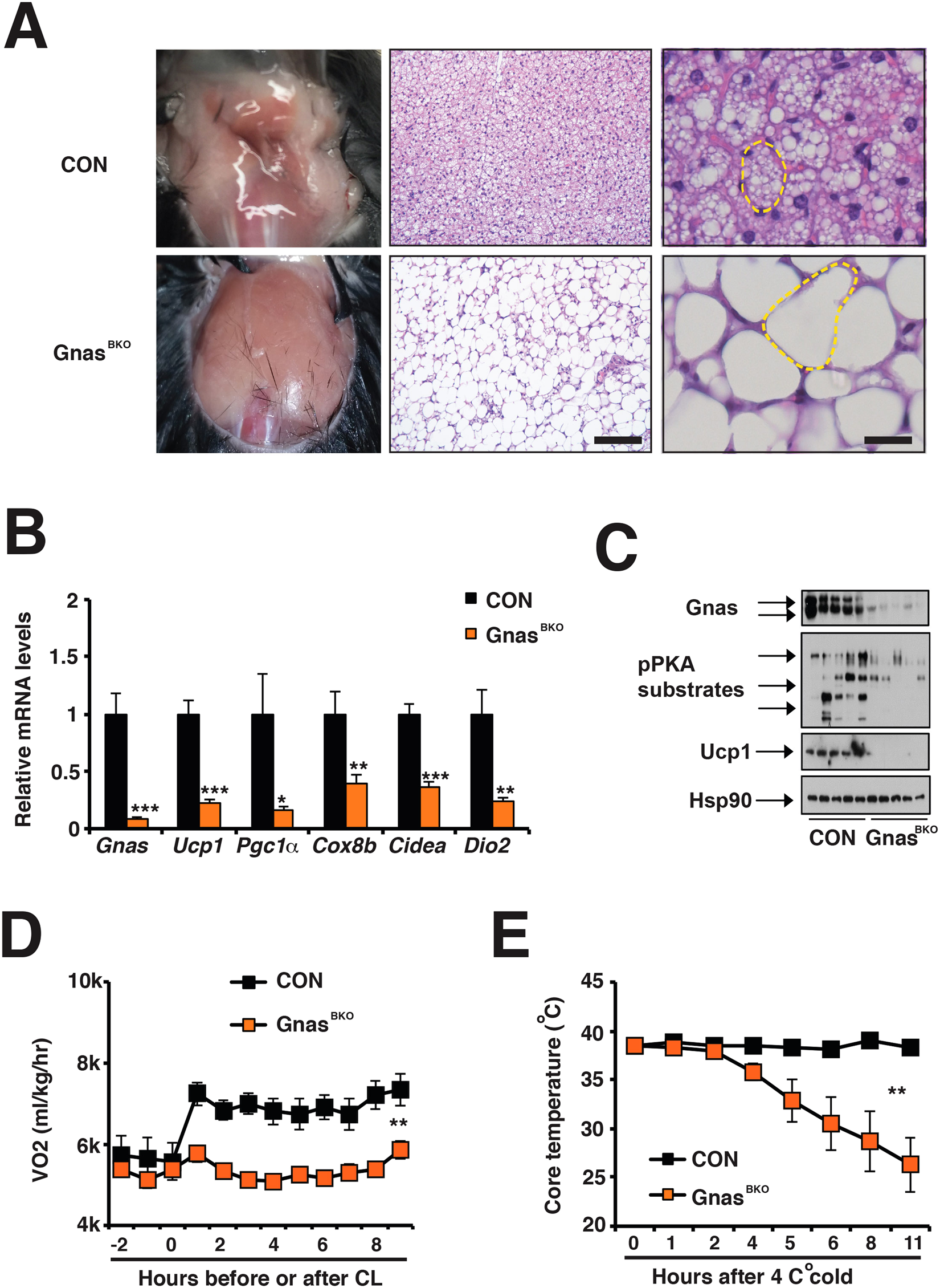 Adipose-specific SAT1 knockout mice develop late-onset obesity.